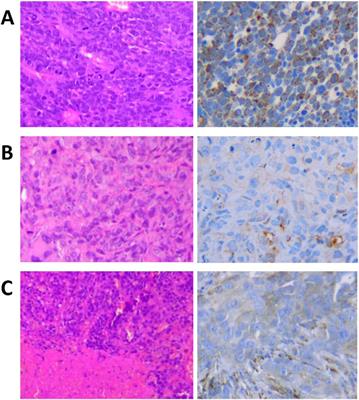 HER2 expression in different cell lines at different inoculation sites assessed by [52Mn]Mn-DOTAGA(anhydride)-trastuzumab